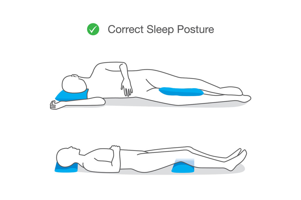 Illustration of correct sleep positions for treating sciatica, including back and side sleeping with supportive pillows.